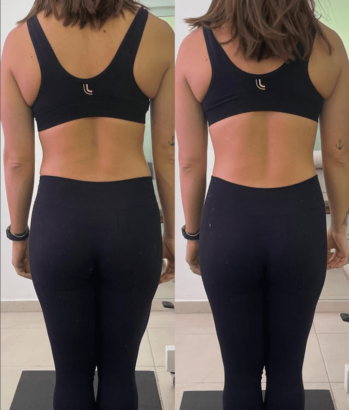 Karine Fonseca Fisioterapia e Pilates em Balneário Camboriú 1 Capturar 3